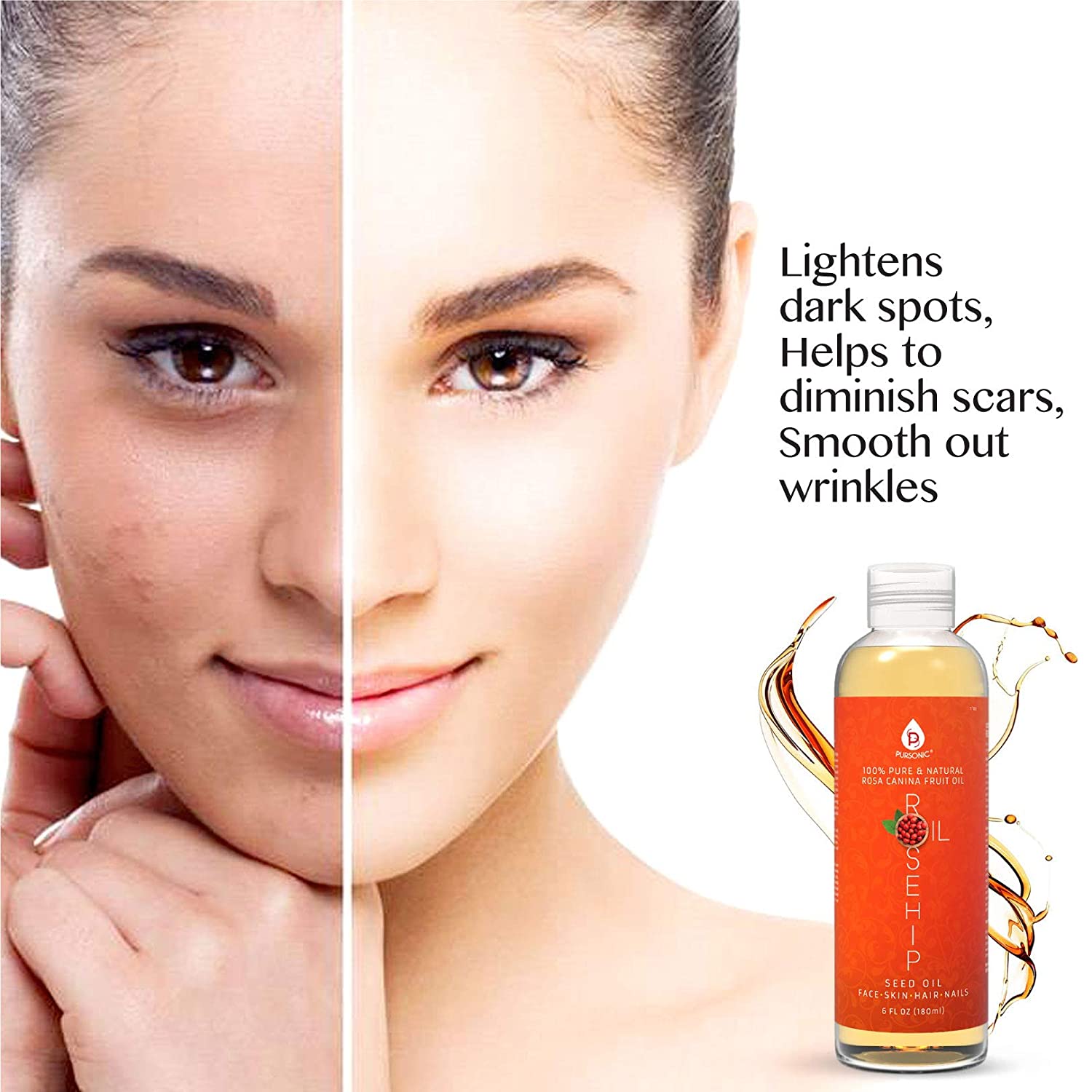 Before and after comparison of a woman's face with a bottle of skincare product on a white background.