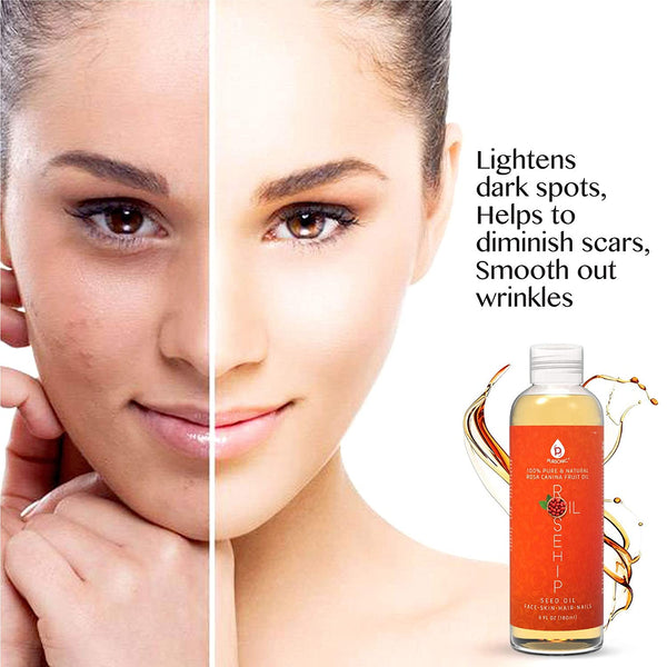 Before and after comparison of a woman's face with a bottle of skincare product on a white background.